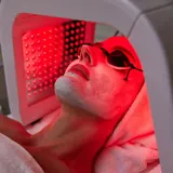 LED light facial session